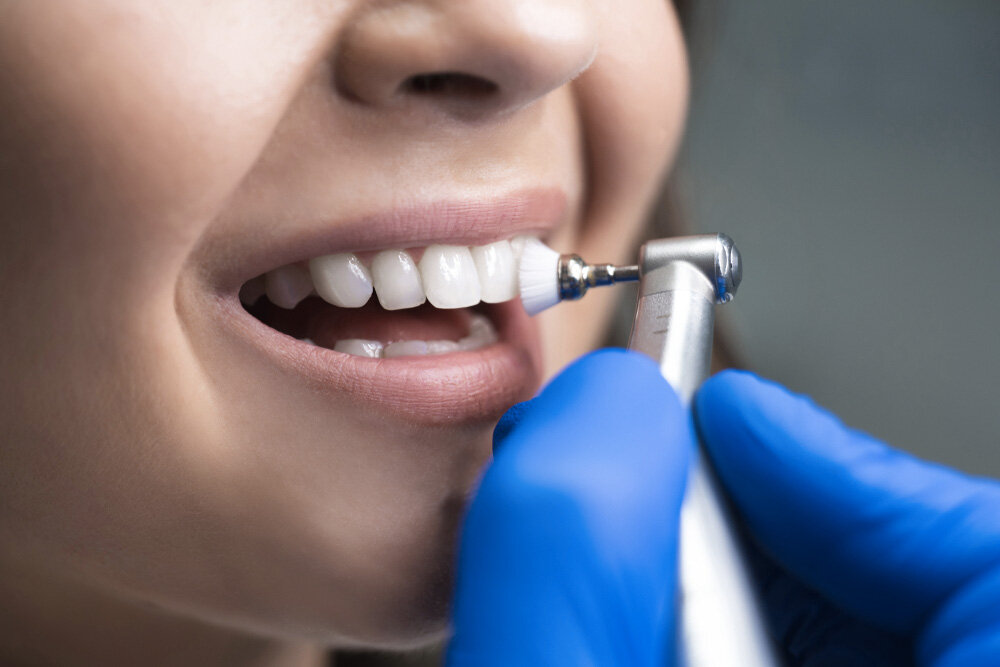 Dentální hygiena
